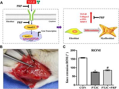 Platelet-rich plasma attenuates the severity of joint capsule fibrosis following post-traumatic joint contracture in rats